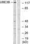 Ubiquitin Protein Ligase E3B antibody, LS-C120456, Lifespan Biosciences, Western Blot image 