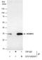 Homeobox protein Hox-B13 antibody, GTX129245, GeneTex, Immunoprecipitation image 