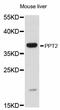 Palmitoyl-Protein Thioesterase 2 antibody, STJ114141, St John