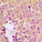 Mitogen-Activated Protein Kinase Kinase 1 antibody, LS-C368430, Lifespan Biosciences, Immunohistochemistry frozen image 