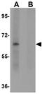 Zinc finger and SCAN domain-containing protein 4 antibody, GTX85205, GeneTex, Western Blot image 