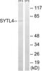 Synaptotagmin Like 4 antibody, PA5-39490, Invitrogen Antibodies, Western Blot image 