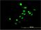 Nuclear receptor subfamily 4 group A member 3 antibody, H00008013-M02, Novus Biologicals, Immunocytochemistry image 