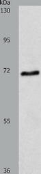 ATP Binding Cassette Subfamily G Member 4 antibody, TA323897, Origene, Western Blot image 