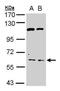 Acetylcholinesterase antibody, PA5-21272, Invitrogen Antibodies, Western Blot image 