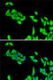 Cyclin Dependent Kinase 5 antibody, 19-820, ProSci, Immunofluorescence image 