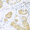 Ubiquitin C-Terminal Hydrolase L3 antibody, A05004, Boster Biological Technology, Immunohistochemistry paraffin image 