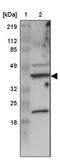 BOP antibody, PA5-51446, Invitrogen Antibodies, Western Blot image 