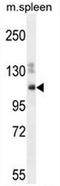 Spectrin Repeat Containing Nuclear Envelope Family Member 3 antibody, AP54124PU-N, Origene, Western Blot image 