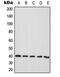 ATPase Na+/K+ Transporting Subunit Beta 3 antibody, MBS8218662, MyBioSource, Western Blot image 