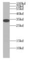 NSF Attachment Protein Alpha antibody, FNab00344, FineTest, Western Blot image 