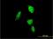 Proteasome 20S alpha 6 antibody, H00005687-B01P, Novus Biologicals, Immunofluorescence image 