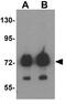 ATPase Family AAA Domain Containing 3B antibody, GTX32018, GeneTex, Western Blot image 