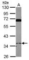 EP300 Interacting Inhibitor Of Differentiation 3 antibody, NBP2-14943, Novus Biologicals, Western Blot image 
