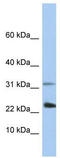 Exosome complex exonuclease RRP40 antibody, TA345699, Origene, Western Blot image 