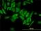 Ribosomal Protein L4 antibody, H00006124-M01, Novus Biologicals, Immunocytochemistry image 