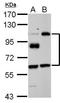 LIM Domain And Actin Binding 1 antibody, GTX120889, GeneTex, Western Blot image 