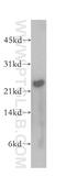Mitotic spindle assembly checkpoint protein MAD2B antibody, 12683-1-AP, Proteintech Group, Western Blot image 
