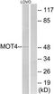 Monocarboxylate transporter 4 antibody, TA314860, Origene, Western Blot image 