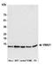 Vacuolar ATPase Assembly Factor VMA21 antibody, A305-700A-M, Bethyl Labs, Western Blot image 