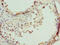 CPX Chromosome Region Candidate 1 antibody, CSB-PA822678LA01HU, Cusabio, Immunohistochemistry frozen image 