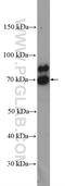 DEAD-Box Helicase 3 Y-Linked antibody, 14041-1-AP, Proteintech Group, Western Blot image 