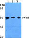 Interferon Alpha And Beta Receptor Subunit 1 antibody, AP06615PU-N, Origene, Western Blot image 