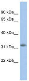 Neugrin, Neurite Outgrowth Associated antibody, TA344220, Origene, Western Blot image 