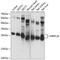 Mitochondrial Ribosomal Protein L24 antibody, 19-511, ProSci, Western Blot image 