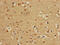 Carnitine O-palmitoyltransferase 1, brain isoform antibody, CSB-PA855048LA01HU, Cusabio, Immunohistochemistry frozen image 