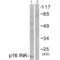 Cyclin-dependent kinase inhibitor 2A, isoforms 1/2/3 antibody, SPC-1280D-A594, StressMarq, Western Blot image 