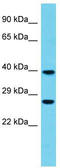F-Box Protein 44 antibody, TA331684, Origene, Western Blot image 