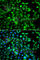 Calpain-5 antibody, A7428, ABclonal Technology, Immunofluorescence image 