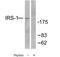 Insulin Receptor Substrate 1 antibody, TA312858, Origene, Western Blot image 