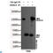Histone Deacetylase 4 antibody, LS-C812989, Lifespan Biosciences, Immunoprecipitation image 