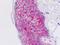 Epithelial membrane protein 2 antibody, orb137274, Biorbyt, Immunohistochemistry paraffin image 