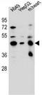 Leucine Rich Repeat Containing 28 antibody, AP52530PU-N, Origene, Western Blot image 