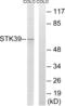 Serine/Threonine Kinase 39 antibody, abx014927, Abbexa, Western Blot image 