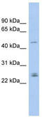 Doublesex And Mab-3 Related Transcription Factor 3 antibody, TA331792, Origene, Western Blot image 