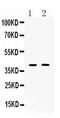 ISL LIM Homeobox 1 antibody, PA5-79524, Invitrogen Antibodies, Western Blot image 