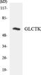 Glycerate Kinase antibody, LS-C291995, Lifespan Biosciences, Western Blot image 