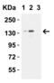 Lysine-specific demethylase 6B antibody, 6657, ProSci, Western Blot image 