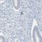 ADP-Ribosyltransferase 3 antibody, HPA011268, Atlas Antibodies, Immunohistochemistry frozen image 
