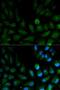 Capping Actin Protein Of Muscle Z-Line Subunit Alpha 2 antibody, LS-C331856, Lifespan Biosciences, Immunofluorescence image 
