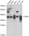 Canopy FGF Signaling Regulator 3 antibody, GTX55574, GeneTex, Western Blot image 