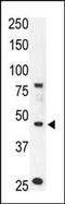 Atypical Chemokine Receptor 2 antibody, 60-884, ProSci, Western Blot image 