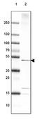 3-Hydroxyacyl-CoA Dehydratase 3 antibody, NBP1-88597, Novus Biologicals, Western Blot image 