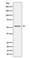 Solute carrier family 45 member 3 antibody, M11232, Boster Biological Technology, Western Blot image 