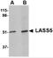 Ceramide Synthase 5 antibody, 4939, ProSci Inc, Western Blot image 