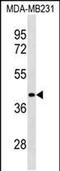 Leucine Rich Repeat Containing 39 antibody, PA5-49166, Invitrogen Antibodies, Western Blot image 